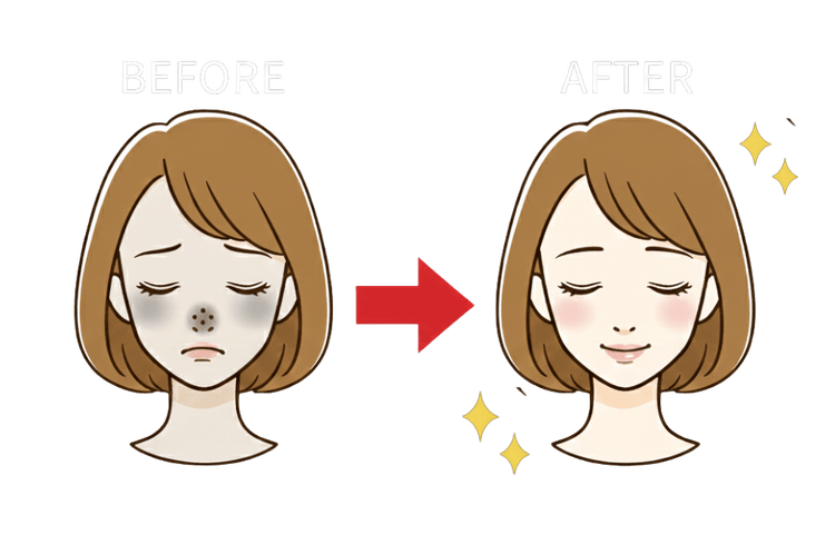 肌質改善イメージ