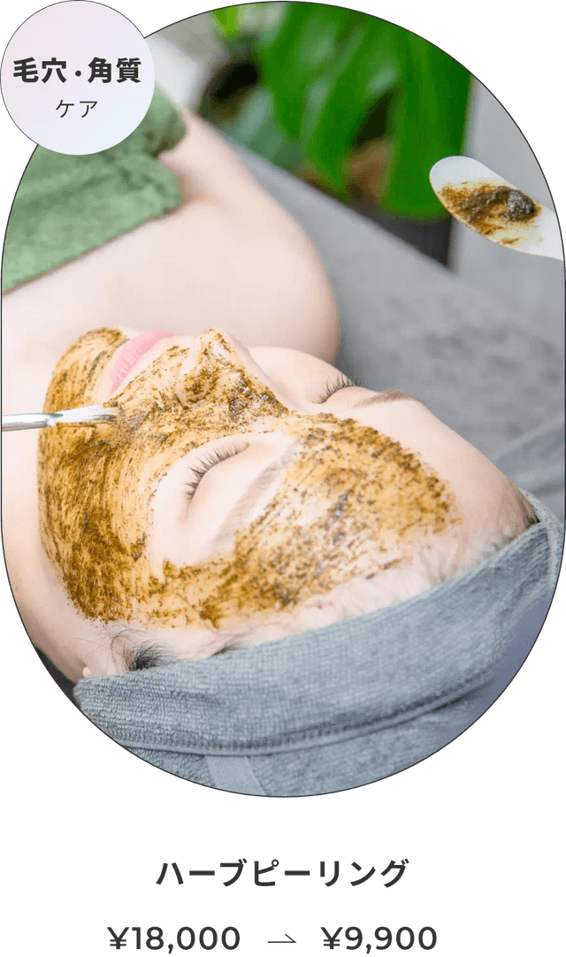 ハーブピーリング